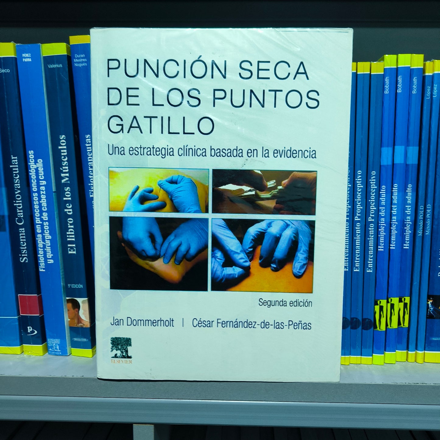 PUNCIÓN SECA DE LOS PUNTOS GATILLO‚ Una estrategia clínica basada en la evidencia